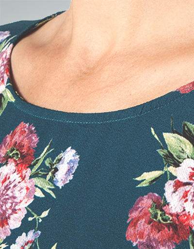 LIU JO Damen Kleid W68255T9052/V9442 Image 1